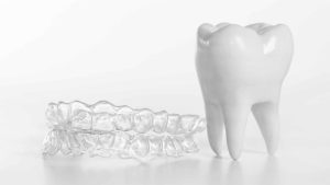 ortodoncja bronowice- gabinet ortodontyczny Kraków-aparaty ortodontyczne-ortidnta-katarzyna-strusiewicz-bieniek (21)