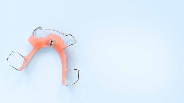 ortodoncja bronowice- gabinet ortodontyczny Kraków-aparaty ortodontyczne-ortidnta-katarzyna-strusiewicz-bieniek (22)