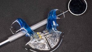 ortodoncja bronowice- gabinet ortodontyczny Kraków-aparaty ortodontyczne-ortidnta-katarzyna-strusiewicz-bieniek (24)