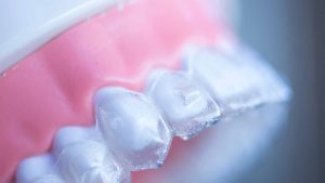 ortodoncja bronowice- gabinet ortodontyczny Kraków-aparaty ortodontyczne-ortidnta-katarzyna-strusiewicz-bieniek (33)